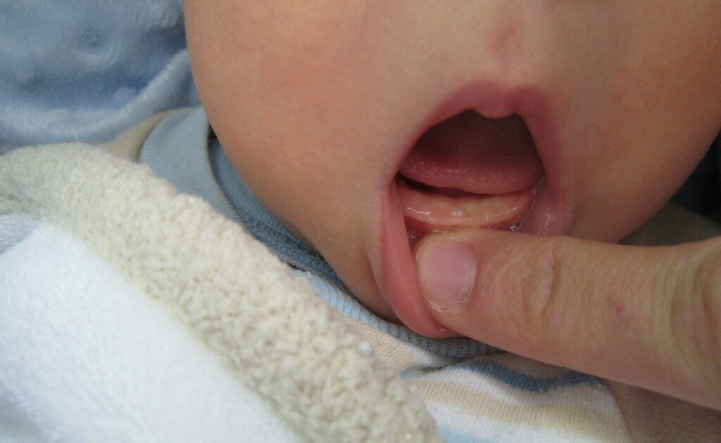 signs of teething in breastfed babies